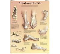 3B Scientific Tableau éducatif des déformations du pied, pieds plats, pieds creux, hallux valgus et troubles du pied