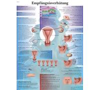 3B Scientific Tableau éducatif laminé - Contraception