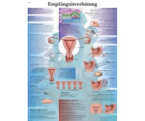 3B Scientific Tableau éducatif laminé - Contraception