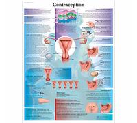 3B Scientific - Tableau Laminé de la Contraception - Affiche Éducative Protégée contre les UV et la Poussière pour Étude, Enseignement & Cliniques