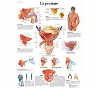 3B Scientific - Tableau Laminé de la Prostate - Affiche d’Anatomie & Physiologie Protégée contre les UV et la Poussière pour Étude, Enseignement & Cliniques