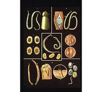 3B Scientific V2028M Planche Parasites intestinaux II