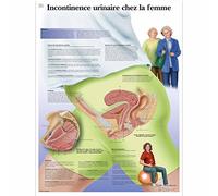 3B Scientific VR2542L Planche Anatomique, Incontinence Urinaire Chez La Femme