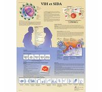 3B Scientific VR2725L Planche Anatomique, HIV et SIDA