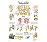 3B Scientific VR3172L imprimé sur papier, Pelvis et hanches, Anatomie et pathologie