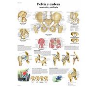 3B Scientific VR3172UU imprimé sur papier, Pelvis et hanches, Anatomie et pathologie