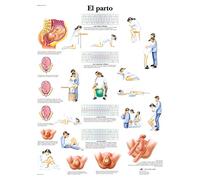 3B Scientific VR3555UU imprimé sur papier, l'accouchement