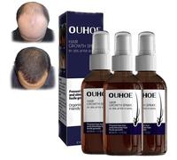 3Pcs Ultra Hairgrowth Formula Serum Spray, Hair Growth Spray, Ultra Hair Growth Formula Serum Spray,Grow Thicker Hair in 8 Weeks