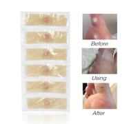 42 Pieces/Ensemble Autocollants De Soin Des Pieds Pied Ma?S Tueur Callosites Epine Soulagement De La Douleur Platre Soins Des Pieds Autocollant Medical Orteil Protecteur Outil