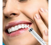 5 Pièces Seringues Dentaires 12 Ml Seringue D'Irrigation Dentaire Avec Pointe Incurvée Échelle Mesure Seringue Dents Sagesse Seringues D'Irrigation Nettoyage Soins Dentaires Bucco-Dentaires (Bl