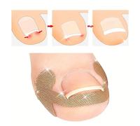 50 pièces/set Correcteur d'ongle incarné, coussinets séparateurs d'orteils, coussins de correction des ongles, convient pour une utilisation quotidienne pour hommes et femmes, amélioration indolore de