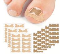 50 pièces/set Correcteur d'ongle incarné, Coussinets séparateurs d'orteils, Coussins de correction des ongles, Traitement des ongles incarnés, Convient pour une utilisation quotidienne pour hommes et 