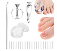 50pcs bandes de correction d'ongle sans douleur + correcteur d'ongle incarné + bâton de levage d'ongle, ensemble de correcteur d'ongle endo, ensemble d'outils endo facile d'utilisation.
