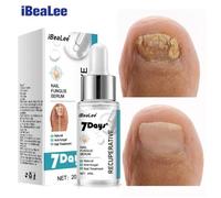 7 jours + sérum de champignon des ongles, anti-fongique, résoudre de multiples problèmes d’ongles,20ml