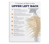 7 Upper Back Anatomy Facts Poster Musculoskeletal System Guide Educational Canvas Living Room Bedroom Wall Art Decor