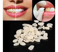 70 Pièces/Paquet Couronne Dentaire Temporaire Résine Ultra Mince Blanchiment Des Dents Ombre Antérieure Placage De Dents Outils De Soin Des Dents Blanc