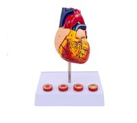 À l'échelle Réelle Modèle de Cœur Comprend 4 Types de Caillots Sanguins à Différents Stades, Étude de Cardiologie Modèle Médical pour Affichage en Classe Communication Médecin-Patient