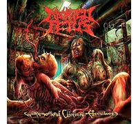 Aborted Fetus - Goresoaked Clinical Accidents [Import]