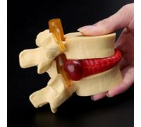 Accessoires Anatomiques De La Colonne Vertébrale Pour Enseignement Médical, Modèles D'anatomie, Outils Médicaux, Hernie Discale, Lombaires, Affranchissement Gratuit, Sans Frais De Port