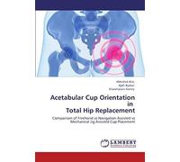 Acetabular Cup Orientation In Total Hip Replacement