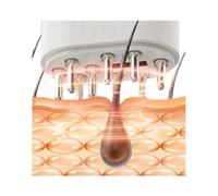 Activateur de follicule pileux, applicateur électrique d'huile de croissance des cheveux, activateur de follicule pileux, soin EMS à double effet lumière rouge ouvre une nouvelle ère de santé du cuir
