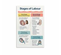 Active Labor Transition Pushing Stage Poster Canvas Wall-Art Obstetrician Reference for Birthing Suite Lactation Room Clinic