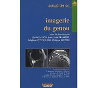 Actualites en imagerie du genou - Brasseur Dion - Sauramps Medical - broché - Etude