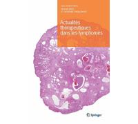 Actualités Thérapeutiques Dans Les Lymphomes