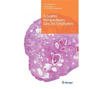 Actualités thérapeutiques dans les lymphomes - Collectif - Springer Vienne - Poche - Livre