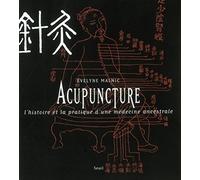 Acupuncture : L'histoire et la pratique d'une médecine ancestrale
