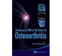 Adv In Mri Of The Knee For Osteoarthriti