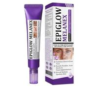 Advanced Anti Hyperpigmentation Cream, 20g Anti Hyperpigmentation Traitements Crème, Cormiotrice Démontage Foncé Profondément Hydratant Visage, Crème Cutanée Faciale Anti Pigmentation