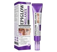 Advanced Anti-Hyperpigmentation Cream, Anti Dark Spot Face Cream, Cream For Hyperpigmentation Treatment, Anti Aging Face Cream, Dark Spot Remover