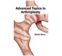 Advanced Topics In Arthroplasty
