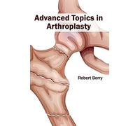 Advanced Topics In Arthroplasty