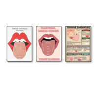 Affiche De Diagnostic De La Langue, Guide D'Étude De La Médecine Traditionnelle Chinoise, Impression Sur Toile De Diagnostic De La Langue, Tableau Mural Sur La Médecine De L'Acupuncture 30X40Cmx3Pcs S