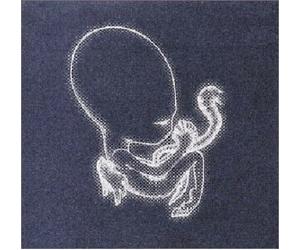 Agaetis Byrjun by Sigur Ros