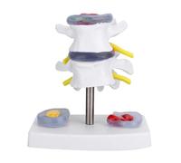 Agatige Modèle de Colonne Lombaire Adulte, modèle d'os Anatomique Humain, modèle d'enseignement de la hernie discale