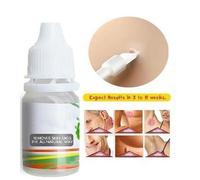 Ages 10ml Peau Étiquette Dissolvant Pied Maïs Verrues Traitement Médecine Chinoise Peau Verrues Enlèvement Verrues Plantaires Soins Pommade