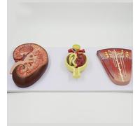 Agrandir la Modèle Anatomique Rénale du Néphron et du Glomérule Identification Numérique, Modèle Anatomique Rénal pour l'éducation médicale et la Formation