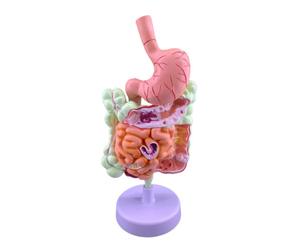 Aide pédagogique en pathologie en astroi pathologique | Modèle d'anatomie en PVC avec structure découpée 3D pour présentation de leçon