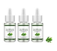 Akne entfernen Gesichtserum, natürliche Zutaten professionell Akne-Markierungen, Feuchtigkeitscreme und feine Poren, für Teenager und Erwachsene Anti-Acne-Feuchtigkeitscreme (3pcs)