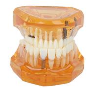 Akozon Modèle de dents 1 pc Modèle standard d'étude d'enseignement dentaire en PVC Démonstration enseigner aux enfants à se brosser les dents Fournitures standard pour adultes (#4)
