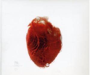Akron - Love is Simple + DVD-Ltd [Import]