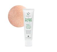 ALHYDRAN Crème pour peaux sèches - Réduit la sécheresse et les pellicules - Gel d'aloe vera - Sans hormones - Hypoallergénique - Hydrate et nourrit la peau - 59 ml