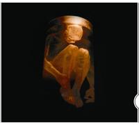 Alice in Chains - Nothing Safe-the Best of the B