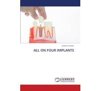 ALL ON FOUR IMPLANTS