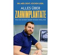 Alles über Zahnimplantate: Was Sie schon immer wissen wollten