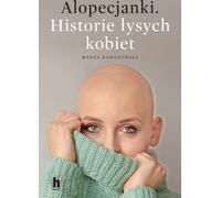 Alopecjanki Historie ³ysych kobiet Marta Krawczyñska (Buch auf Polnisch)