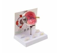 Amagogo Modèle d'Anatomie l'Œil Humain en PVC Base he pour l'Enseignement Médical Patients s Structures Internes Du Globe, Œil Pathologique